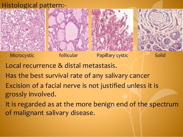 Histological Typing of Salivary Gland Tumours